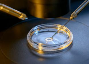 How IVF is carried out: stages of preparation for the procedure and possible complications It is more effective to carry out IVF procedures